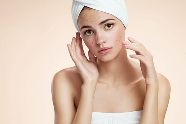 ผิวแพ้ง่าย ทำยังไงดี