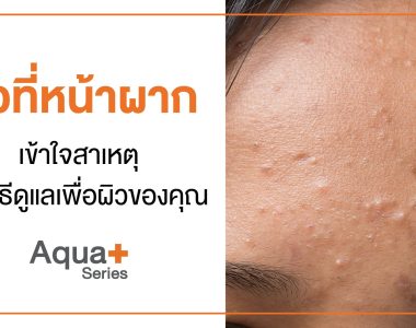 สิวที่หน้าผาก